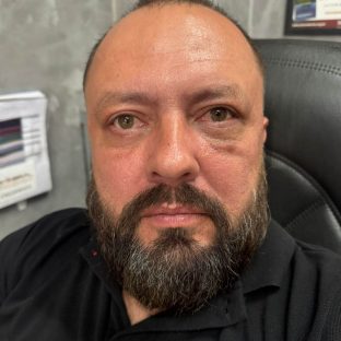 Pós-Operatório em itu com andrssa costa pós de Blefaroplastia-depois